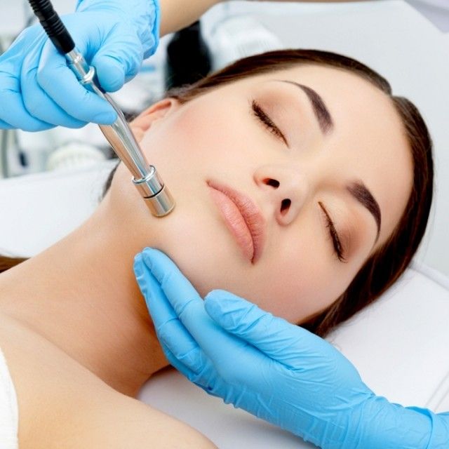 Microdermabrasion Santa Barbara