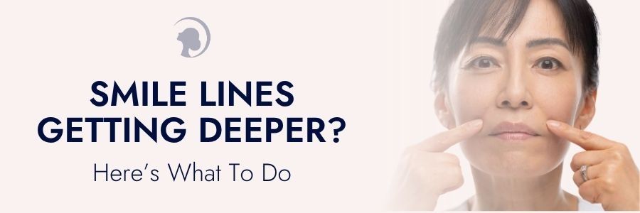 smile lines getting deeper